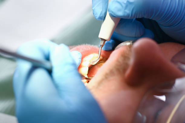 Best Emergency Dentist for Knocked-Out Tooth in Wilmington Manor, DE